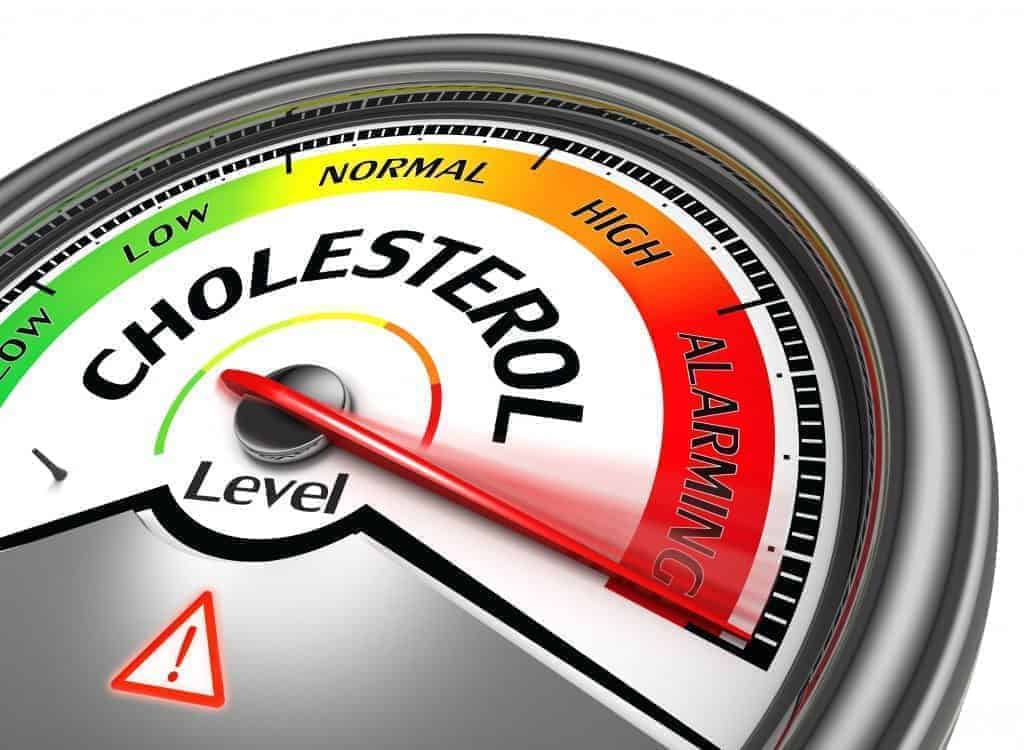 9 điều cần biết về Cholesterol và phương pháp điều trị